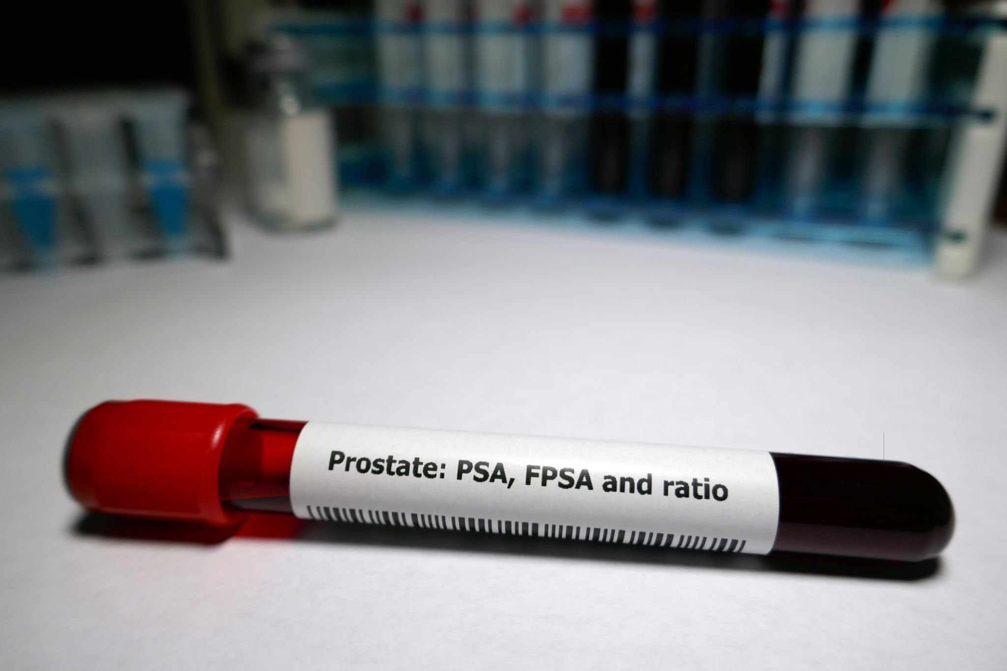 Examen de sangre PSA